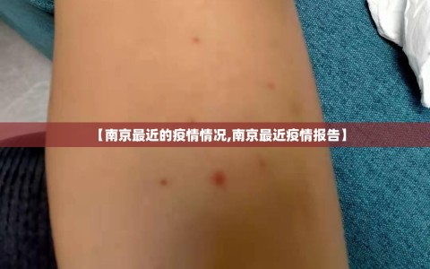【南京最近的疫情情况,南京最近疫情报告】