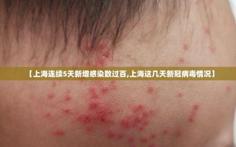 【上海连续5天新增感染数过百,上海这几天新冠病毒情况】
