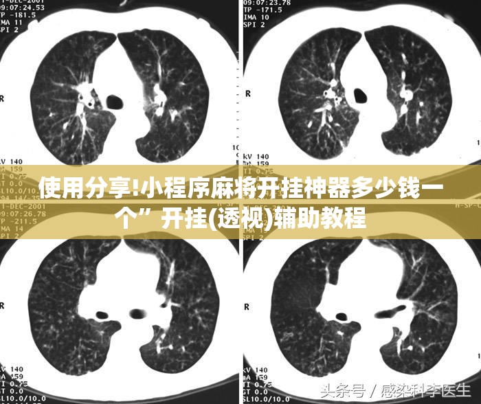 使用分享!小程序麻将开挂神器多少钱一个”开挂(透视)辅助教程
