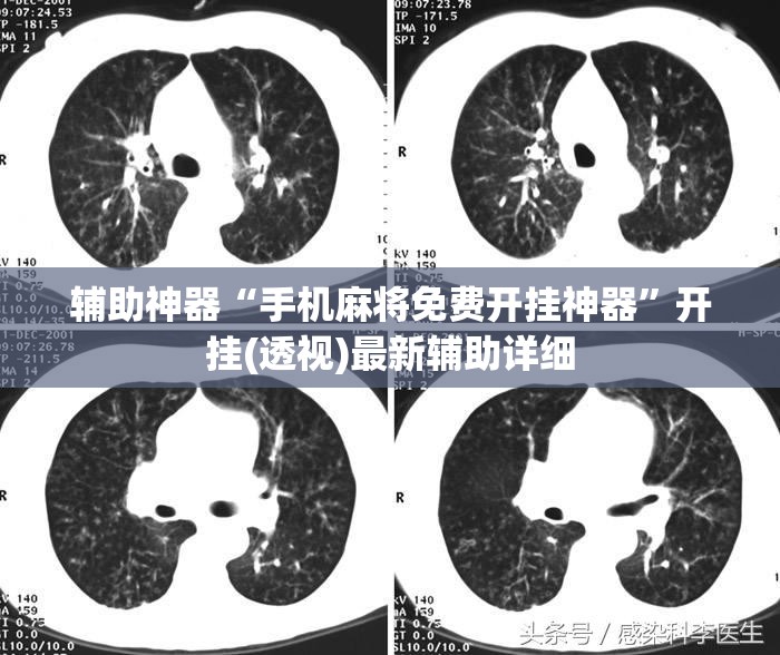 辅助神器“手机麻将免费开挂神器”开挂(透视)最新辅助详细