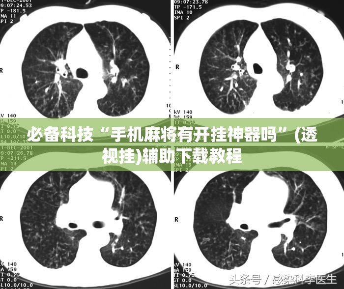 必备科技“手机麻将有开挂神器吗	”(透视挂)辅助下载教程
