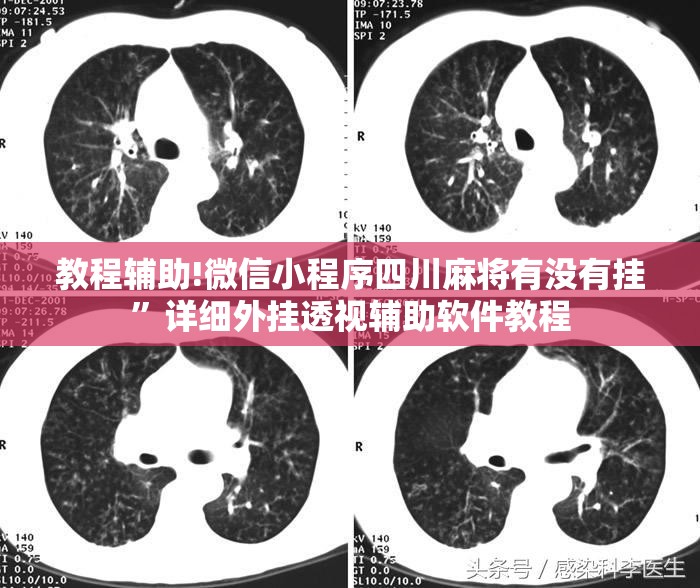 教程辅助!微信小程序四川麻将有没有挂”详细外挂透视辅助软件教程