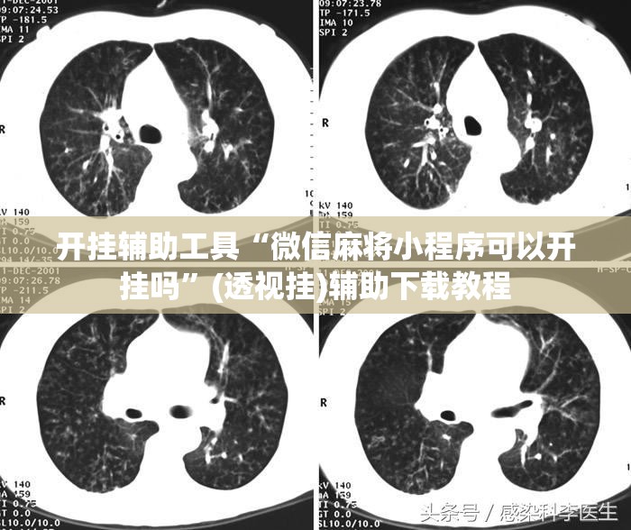 开挂辅助工具“微信麻将小程序可以开挂吗”(透视挂)辅助下载教程
