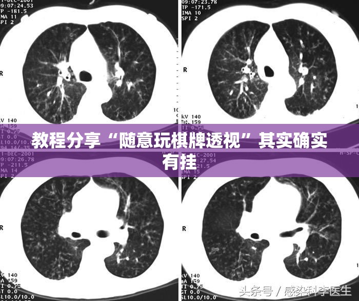 教程分享“随意玩棋牌透视”其实确实有挂