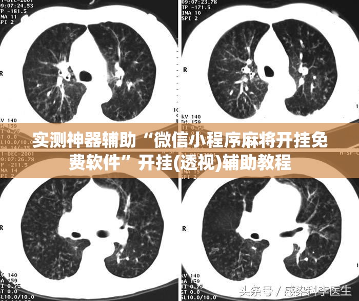实测神器辅助“微信小程序麻将开挂免费软件	”开挂(透视)辅助教程